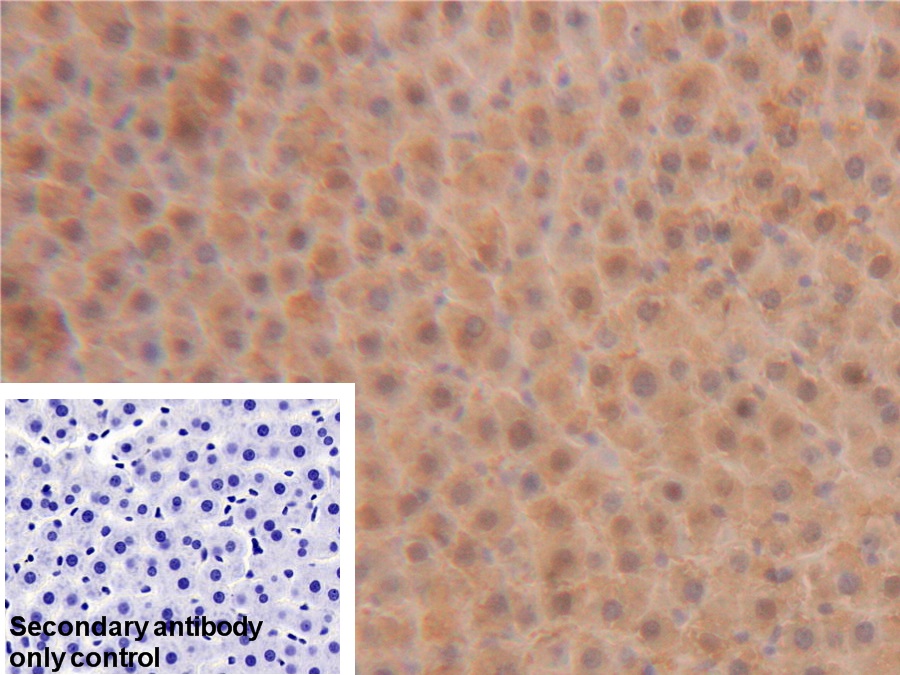 Polyclonal Antibody to Superoxide Dismutase 1 (SOD1)