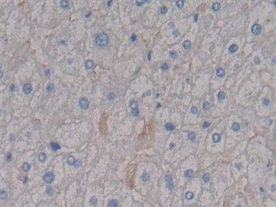 Polyclonal Antibody to Syndecan 1 (SDC1)