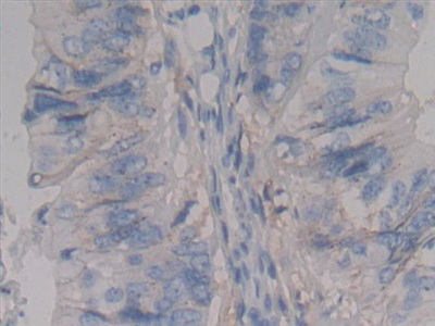 Polyclonal Antibody to Syndecan 1 (SDC1)