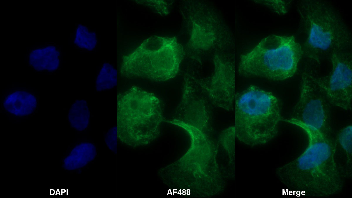 Polyclonal Antibody to Syndecan 1 (SDC1)