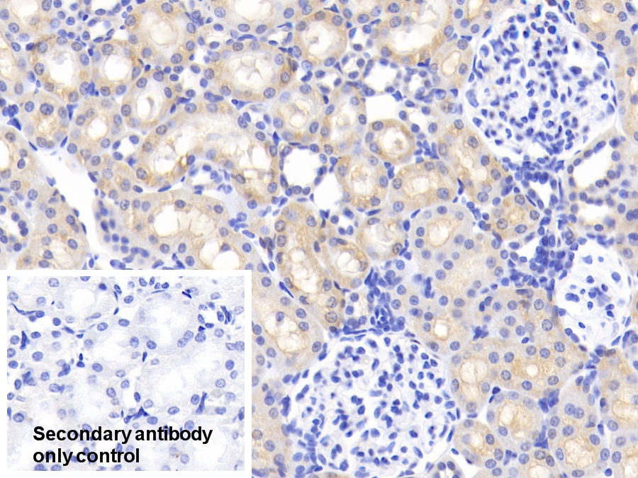 Polyclonal Antibody to Apolipoprotein D (APOD)