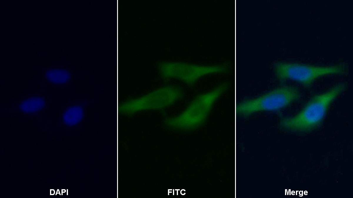 Polyclonal Antibody to Apolipoprotein D (APOD)