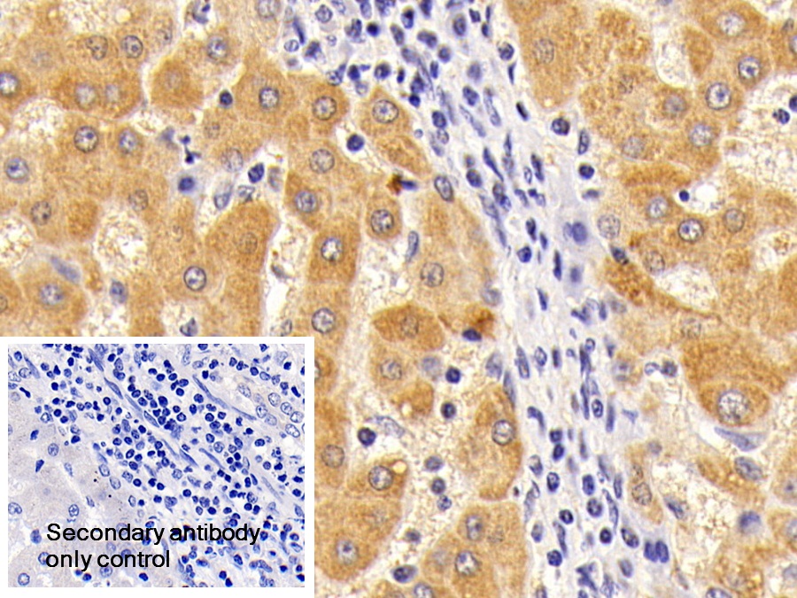 Polyclonal Antibody to Complement Component 5 (C5)