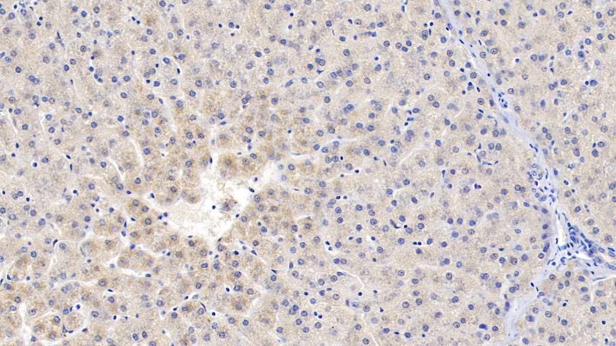 Polyclonal Antibody to Protein S (PROS)