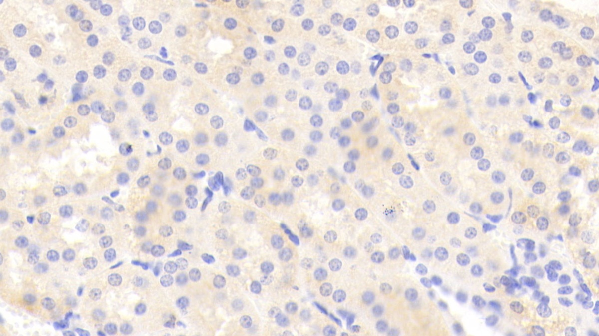 Polyclonal Antibody to Tenascin C (TNC)