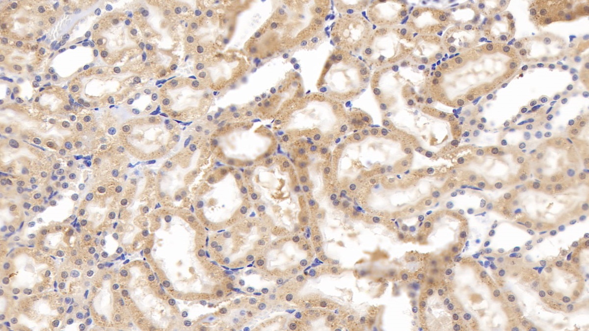 Polyclonal Antibody to Tenascin C (TNC)