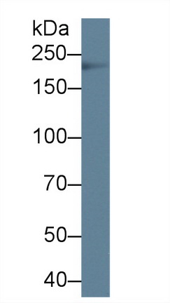 Polyclonal Antibody to Tenascin C (TNC)