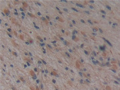 Polyclonal Antibody to Tau Protein (MAPT)