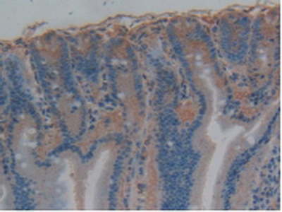 Polyclonal Antibody to Tau Protein (MAPT)