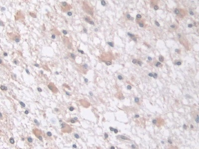 Polyclonal Antibody to Tau-Protein Kinase 1 (tPK1)