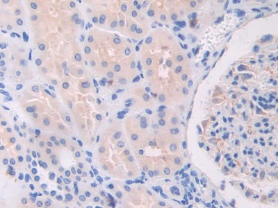 Polyclonal Antibody to Toll Like Receptor 3 (TLR3)