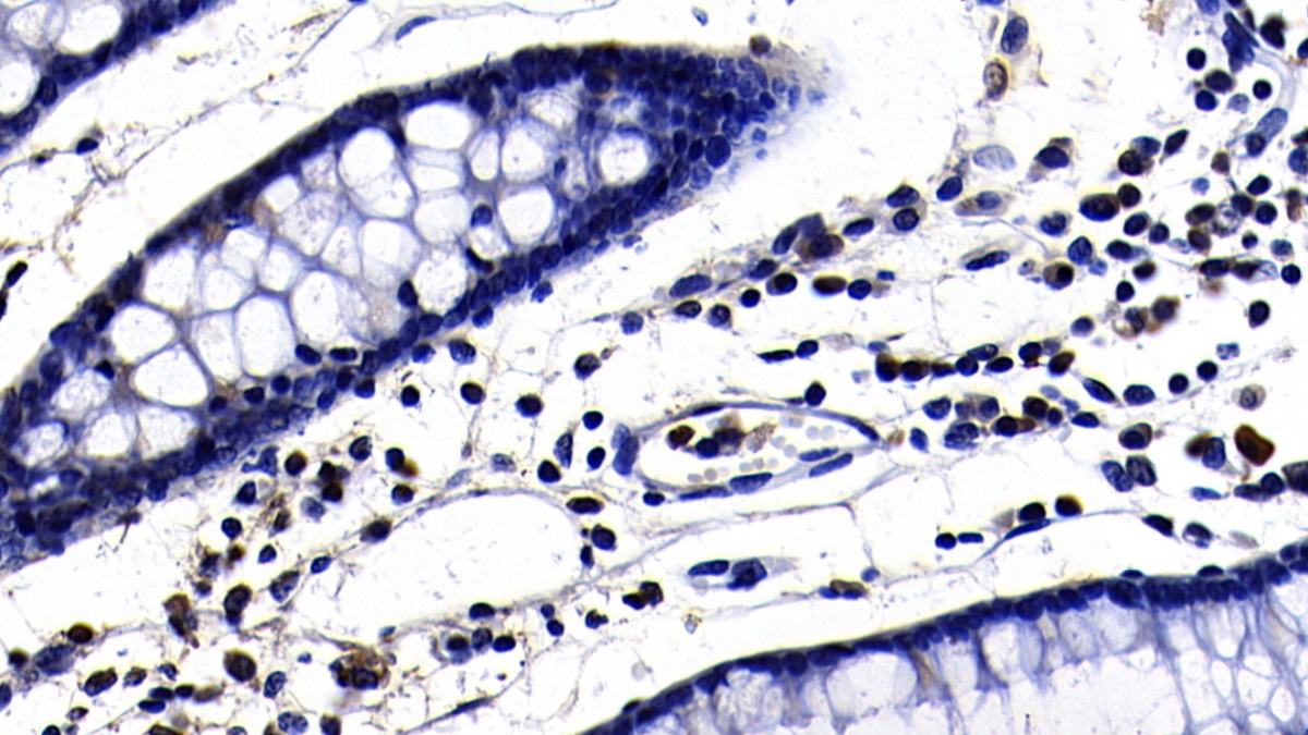 Polyclonal Antibody to Toll Like Receptor 3 (TLR3)