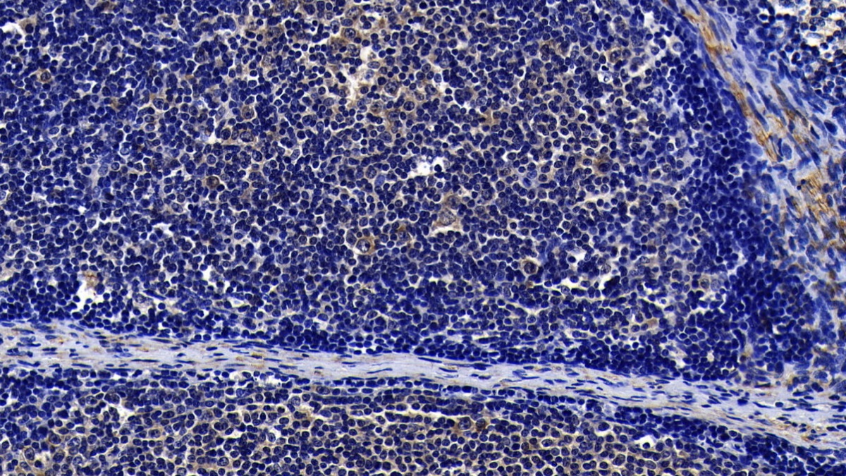 Polyclonal Antibody to Toll Like Receptor 3 (TLR3)