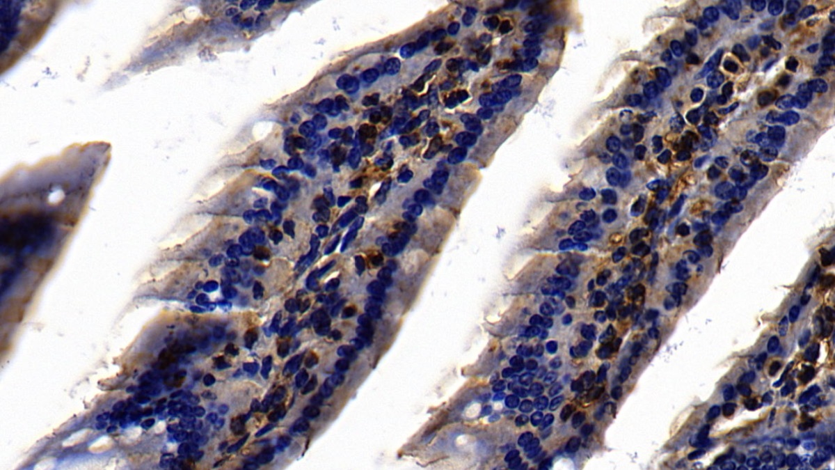 Polyclonal Antibody to Toll Like Receptor 3 (TLR3)