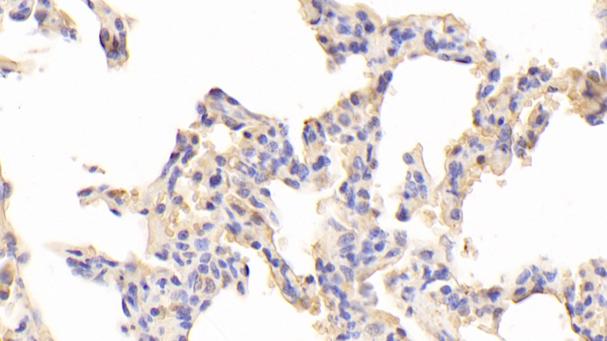 Polyclonal Antibody to Toll Like Receptor 5 (TLR5)