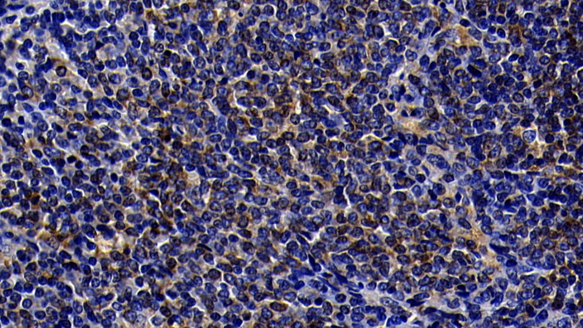 Polyclonal Antibody to Toll Like Receptor 5 (TLR5)