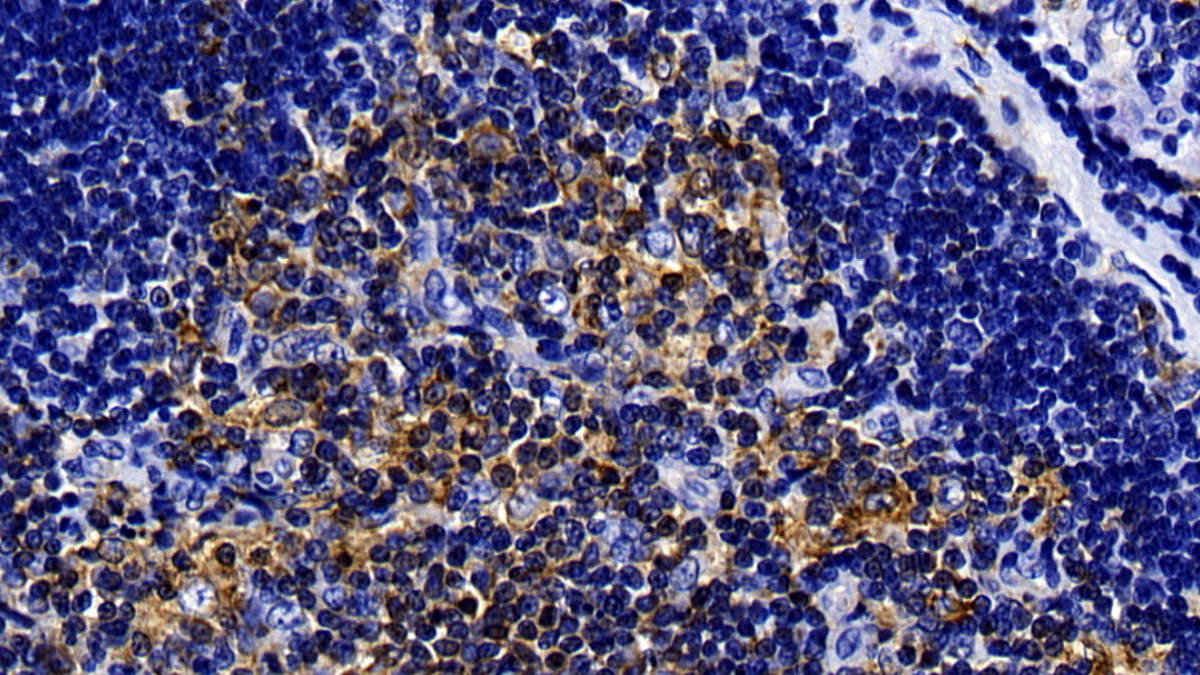 Polyclonal Antibody to Toll Like Receptor 5 (TLR5)