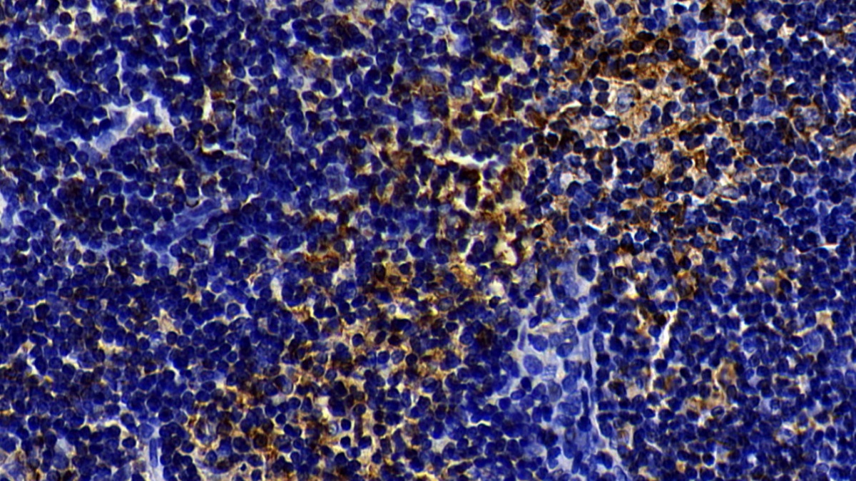 Polyclonal Antibody to Toll Like Receptor 5 (TLR5)