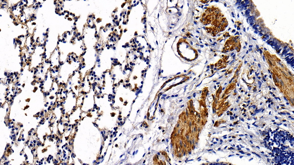 Polyclonal Antibody to Toll Like Receptor 5 (TLR5)