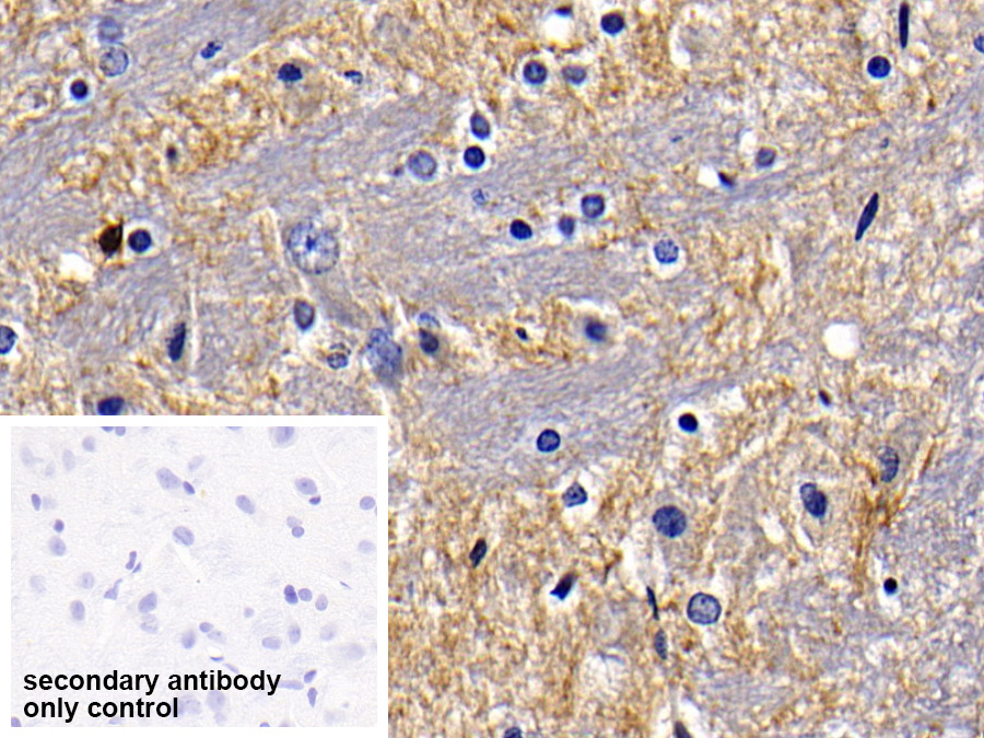 Polyclonal Antibody to Toll Like Receptor 5 (TLR5)