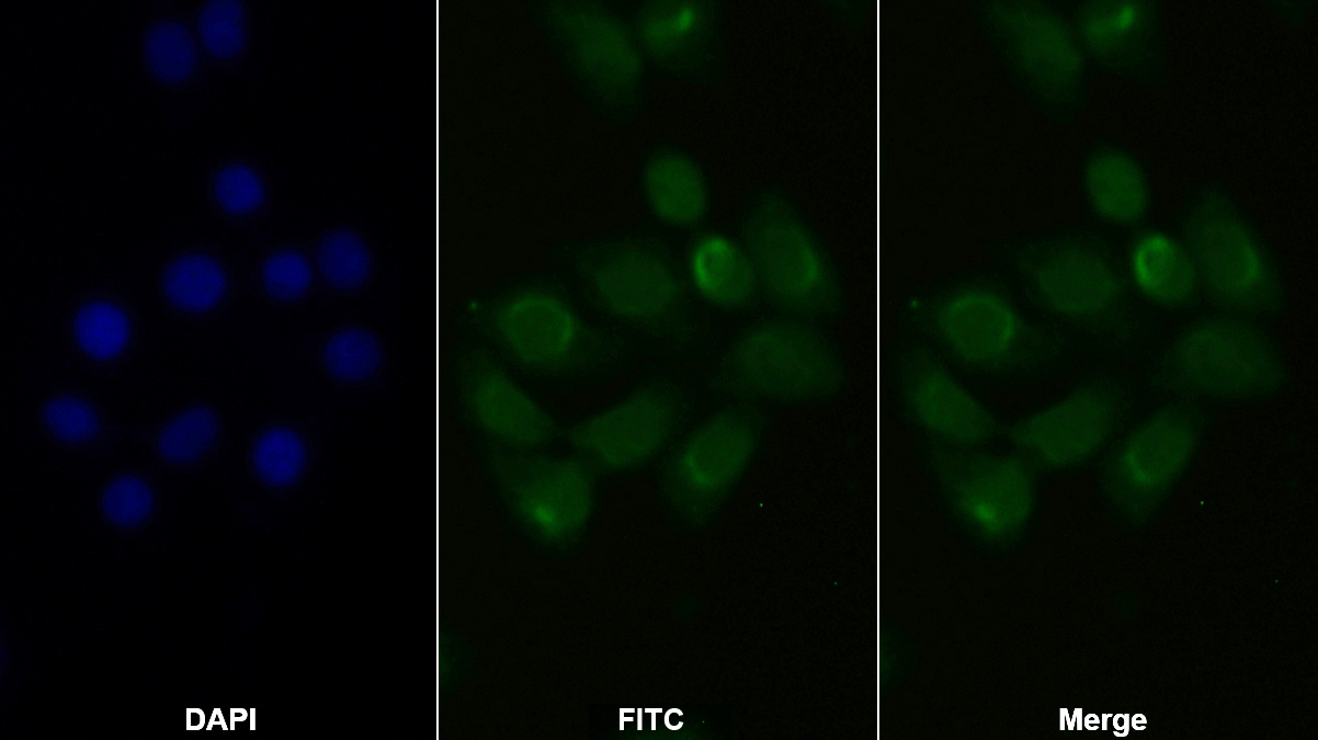 Polyclonal Antibody to Toll Like Receptor 8 (TLR8)