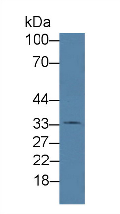 Polyclonal Antibody to Hemojuvelin (HJV)