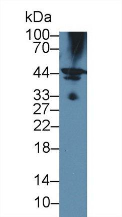 Polyclonal Antibody to Hemojuvelin (HJV)