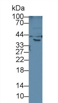 Polyclonal Antibody to Hemojuvelin (HJV)