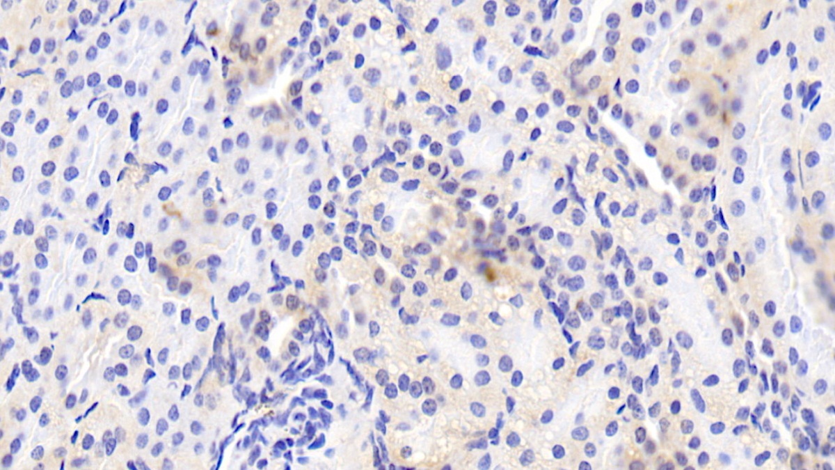 Polyclonal Antibody to Hemojuvelin (HJV)