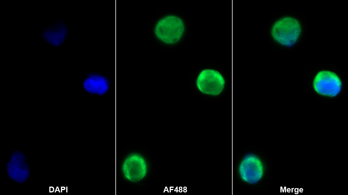 Polyclonal Antibody to Hemojuvelin (HJV)