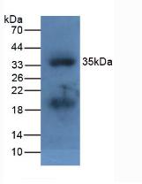 Polyclonal Antibody to Apolipoprotein A5 (APOA5)