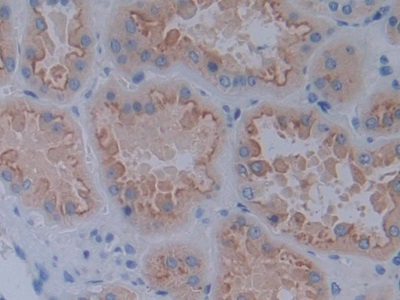 Polyclonal Antibody to Cadherin 17 (CDH17)