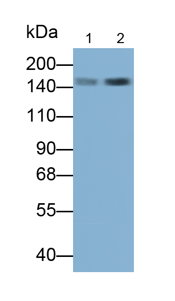 Polyclonal Antibody to Apolipoprotein B (APOB)