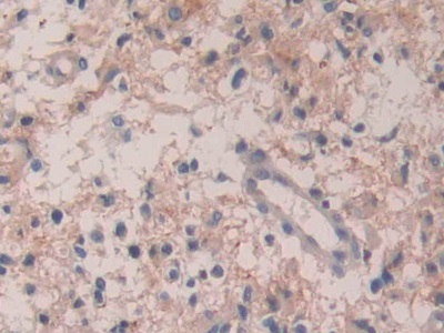 Polyclonal Antibody to Interleukin 35 (IL35)