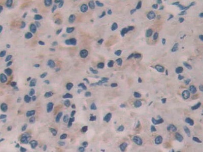 Polyclonal Antibody to Interleukin 35 (IL35)