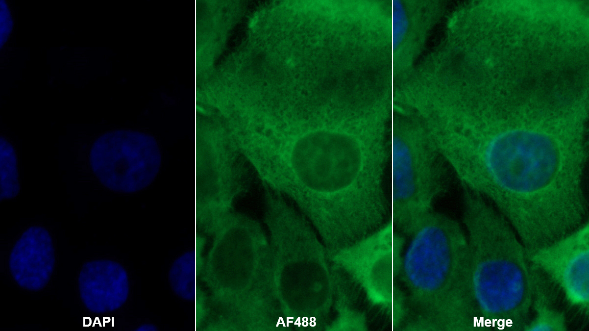 Polyclonal Antibody to S100 Calcium Binding Protein A2 (S100A2)