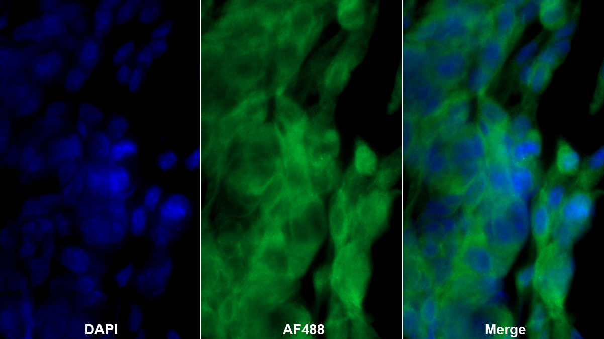 Polyclonal Antibody to Complement Factor B (CFB)