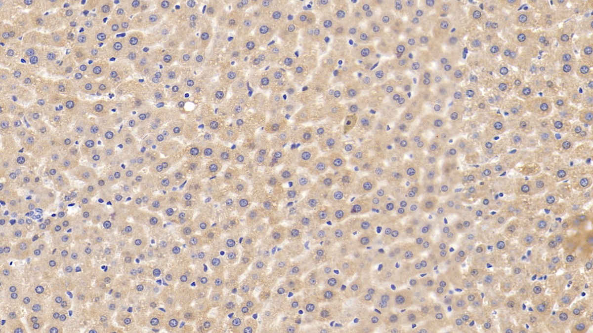 Polyclonal Antibody to Complement Factor B (CFB)