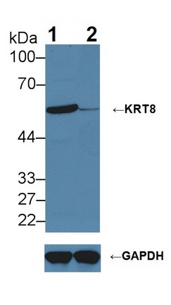 Polyclonal Antibody to Cytokeratin 8 (CK8)