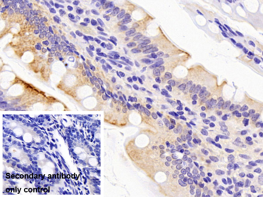 Polyclonal Antibody to Cytokeratin 8 (CK8)