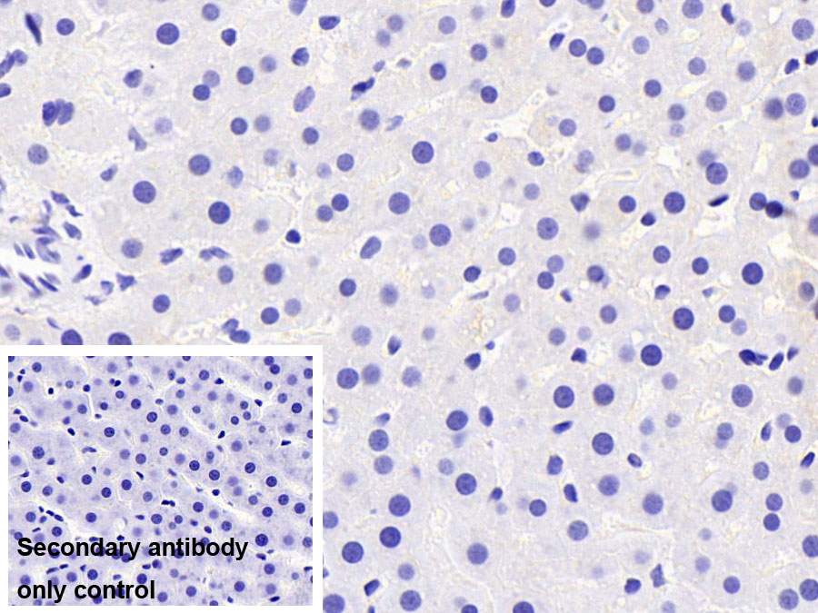 Polyclonal Antibody to Cytokeratin 8 (CK8)