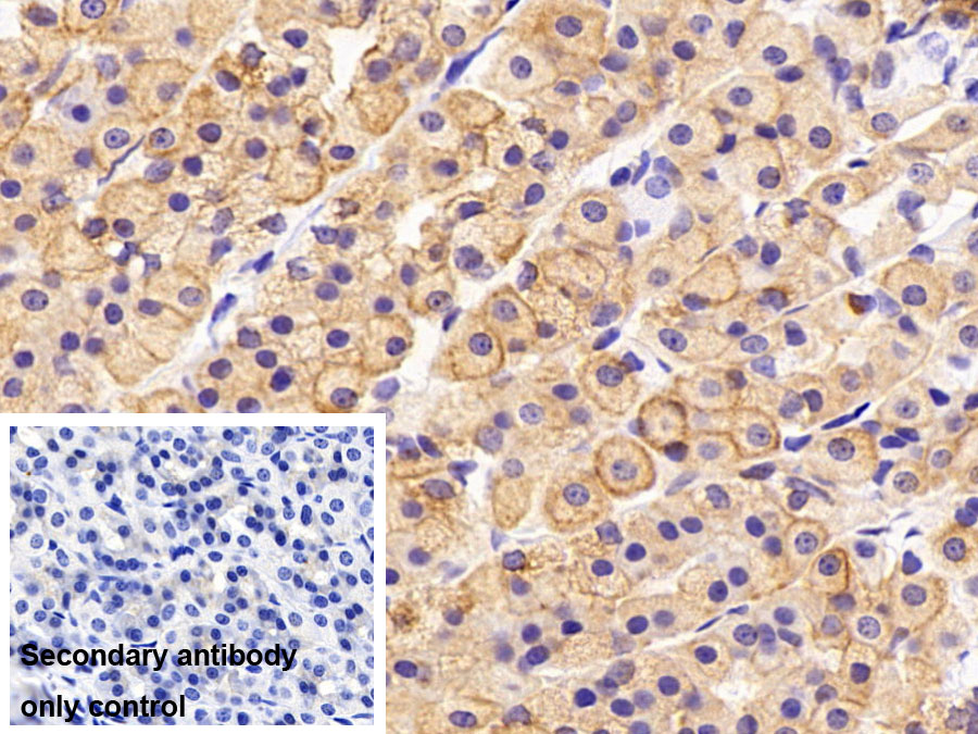 Polyclonal Antibody to Cytokeratin 8 (CK8)