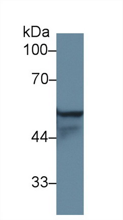 Polyclonal Antibody to Cytokeratin 8 (CK8)