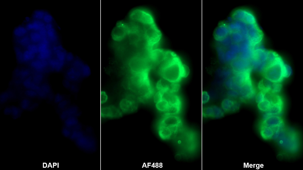 Polyclonal Antibody to Cytokeratin 8 (CK8)