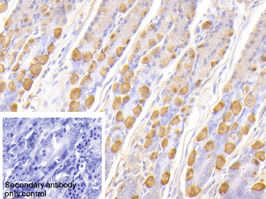 Polyclonal Antibody to Creatine Kinase B (CK-BB)