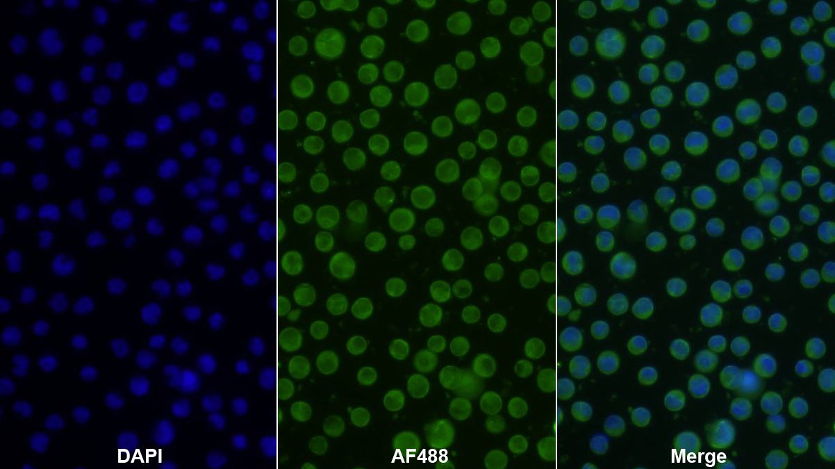 Polyclonal Antibody to Creatine Kinase B (CK-BB)