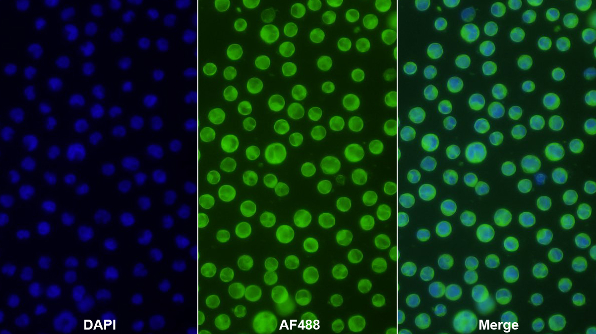 Polyclonal Antibody to Creatine Kinase B (CK-BB)