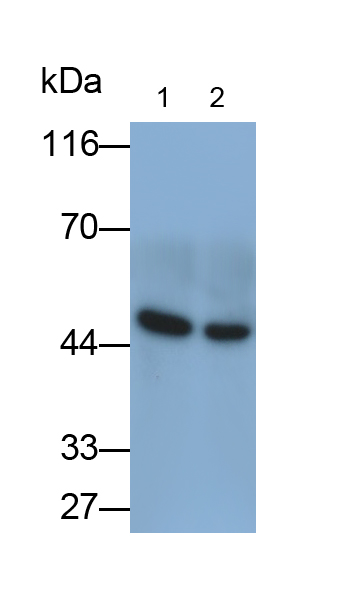 Polyclonal Antibody to Creatine Kinase B (CK-BB)