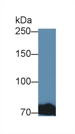 Polyclonal Antibody to Transferrin (TF)