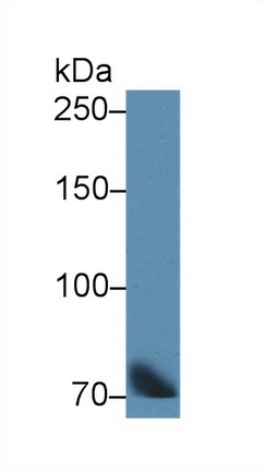 Polyclonal Antibody to Transferrin (TF)